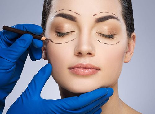 eyelid-surgery-service