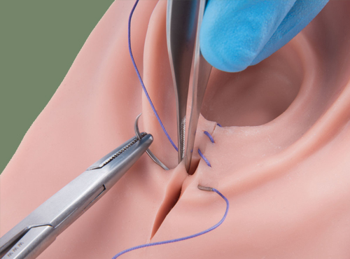 hymenoplasty-service